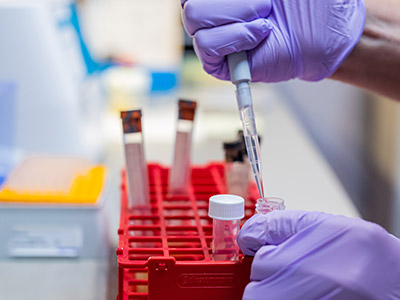 Prenatal Diagnostics